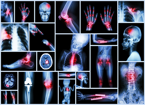 Tips On How Expert Trainers Keep Their Joints Healthy